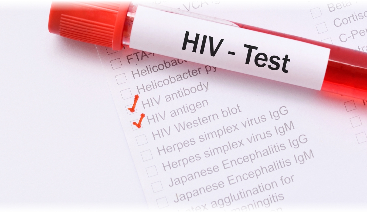 Domowy Test na HIV